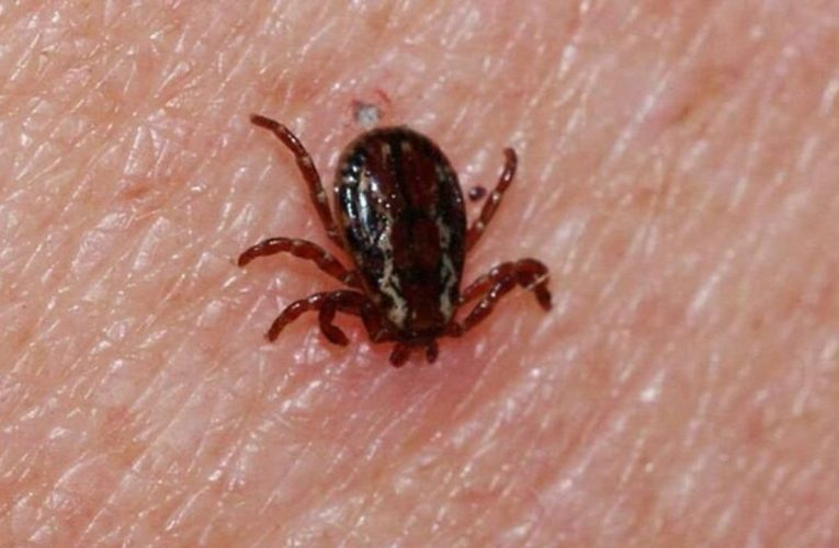 Hayati KKKA uyarısı: Kene müdahalesinde bunları yapmayın