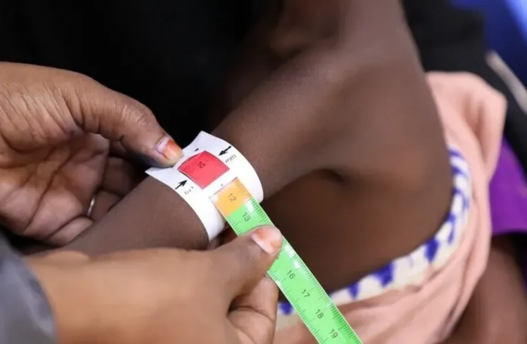 UNICEF, insani yardımların kesildiği Somali’de en büyük bedeli çocukların ödediğini bildirdi