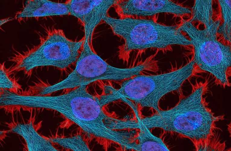 Kanser Tedavisinde Ezber Bozan Protein Keşfi