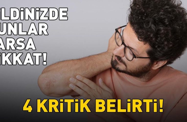 Sedef Hastalığının Belirtileri: Dikkat Edilmesi Gereken 4 İşaret