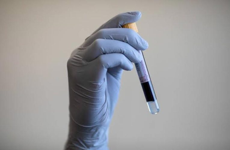 Yeni Araştırma: Kan Testi ile Kanser Riski Yıllar Önceden Tespit Edilebilir